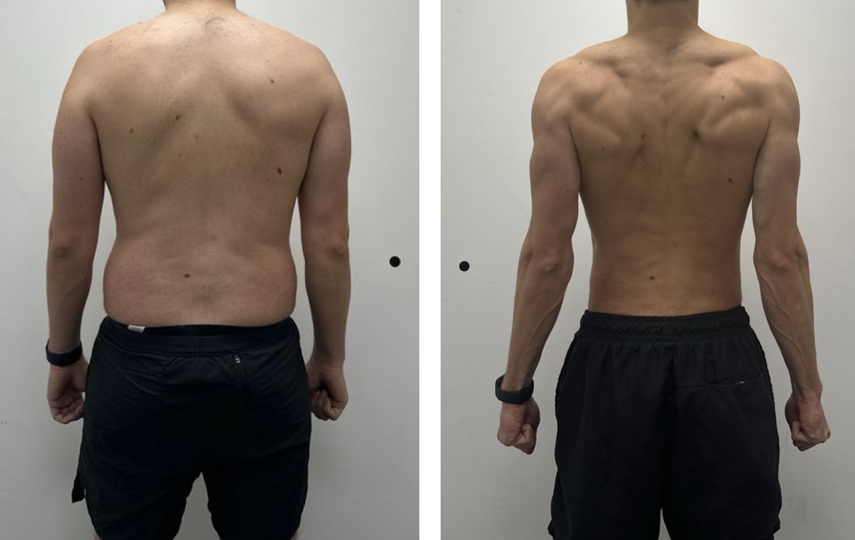 Client A back view, before and after