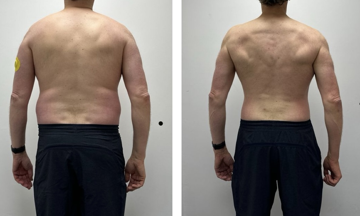 Client B back view, before and after
