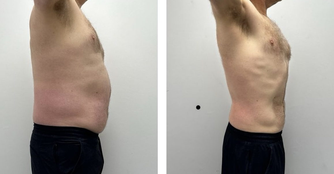 Client B side view, before and after