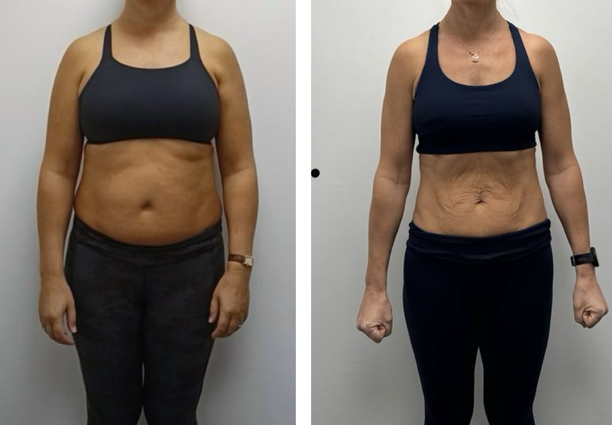 Client C front view, before and after